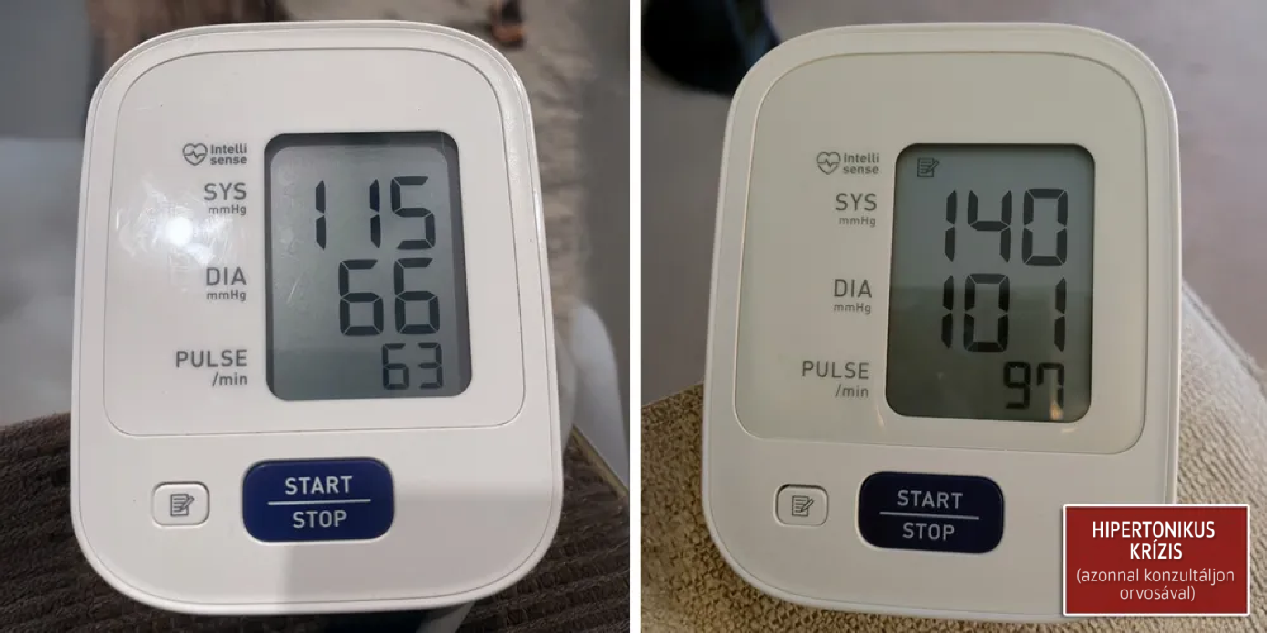 Derila sleep apnea 2 hypertensive crisis HU C SM