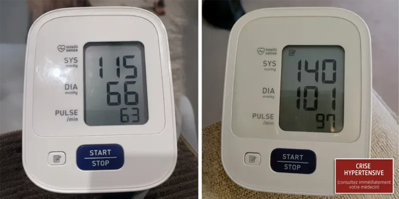 Derila sleep apnea 2 hypertensive crisis C SM FR